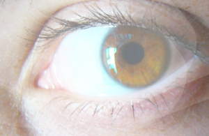 conjuntivitis_0.png